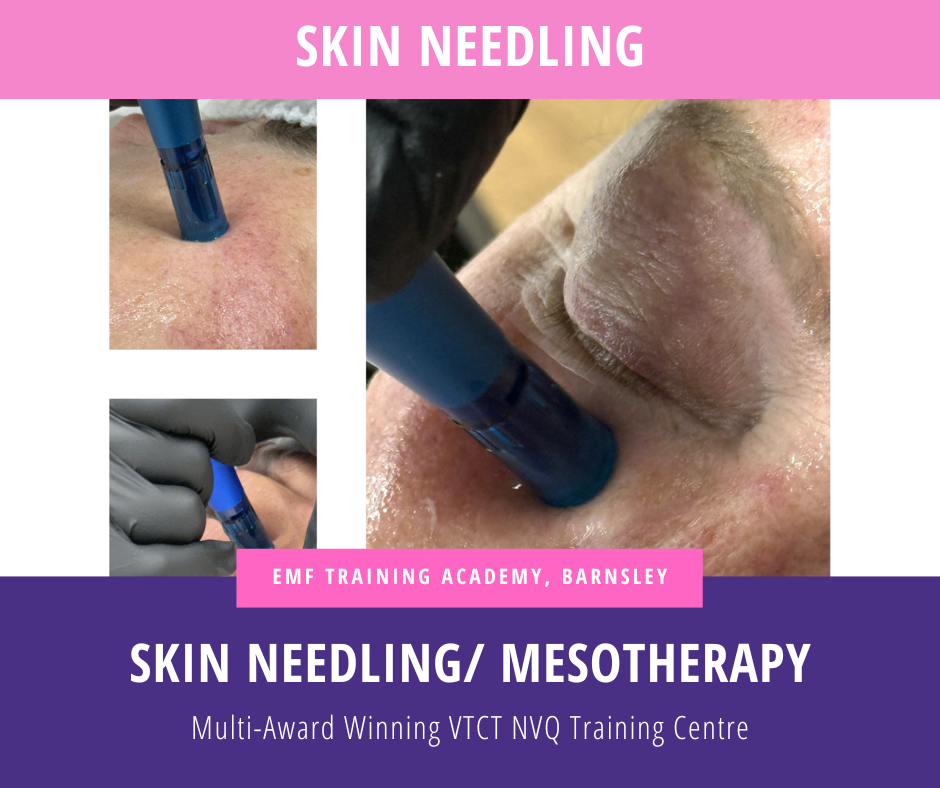 Skin Needling / Dermaroller / Mesotherapy (10am-4pm)