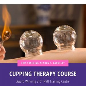 Cupping Therapy (10am-4pm)