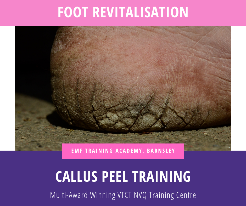 CALLUS PEEL TRAINING COURSE